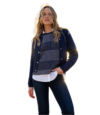 Marble Button Front Cardigan